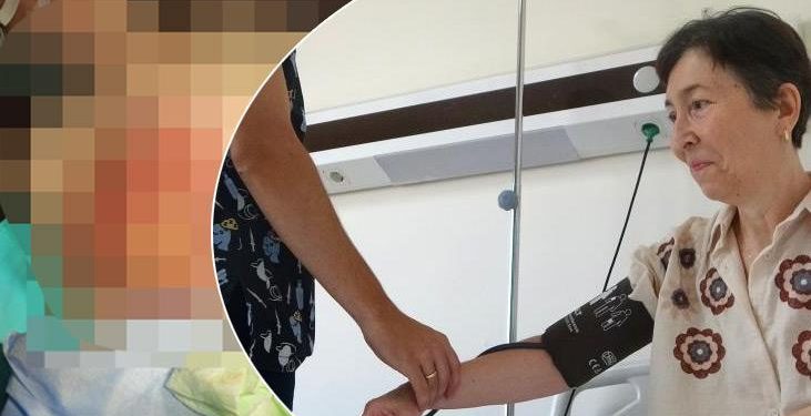 Göğsünde siyahlık başladı, umursamadı! Karpuz kadar büyüyünce patladı