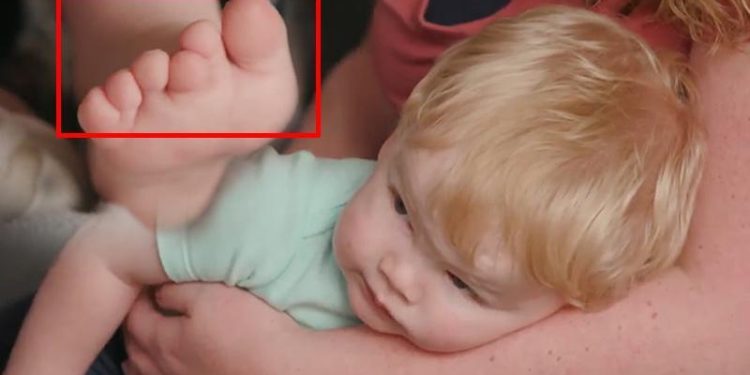 12 parmaklı doğdu, ortalık karıştı! ‘Fotoğrafına bakıp alay ettiler’